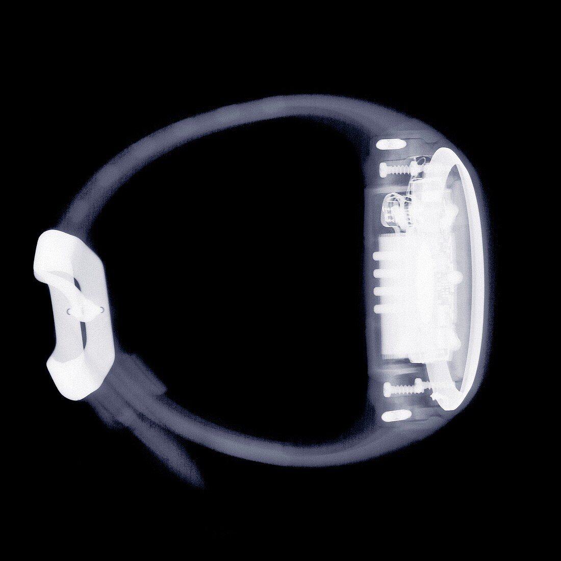 Watch and strap, X-ray