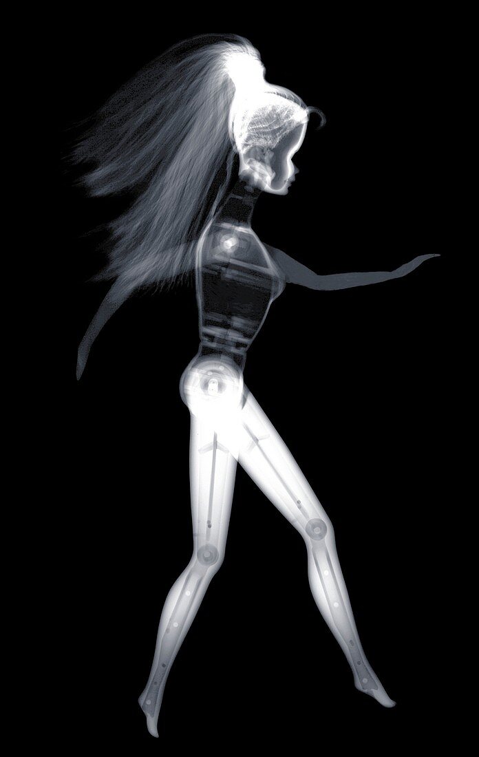 Doll, X-ray