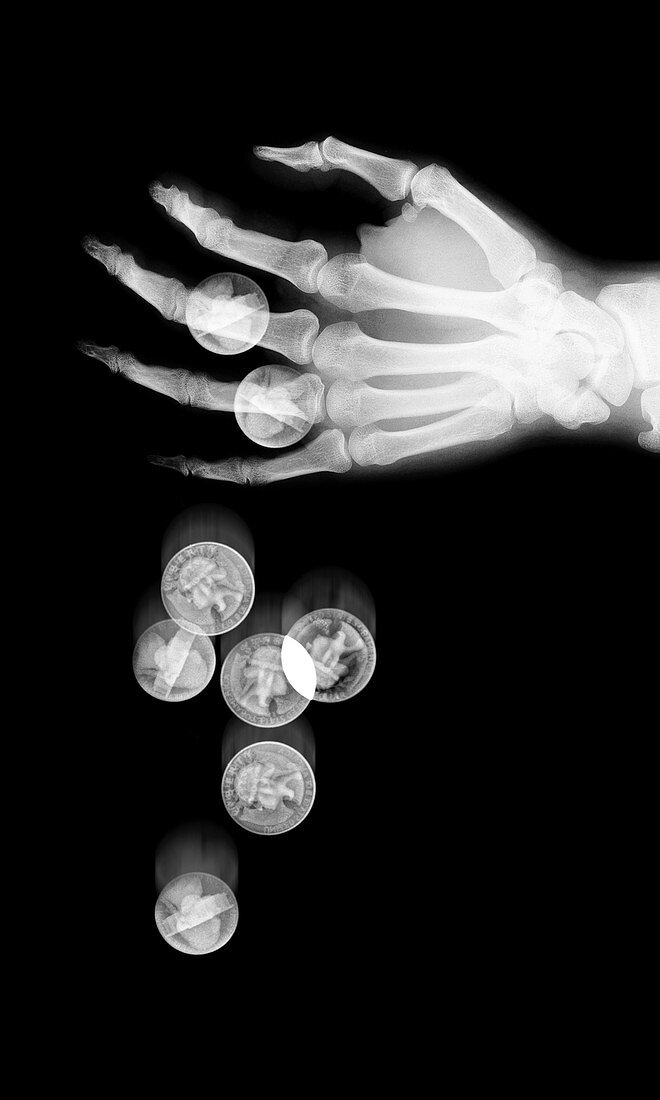 Coins falling from hand, X-ray