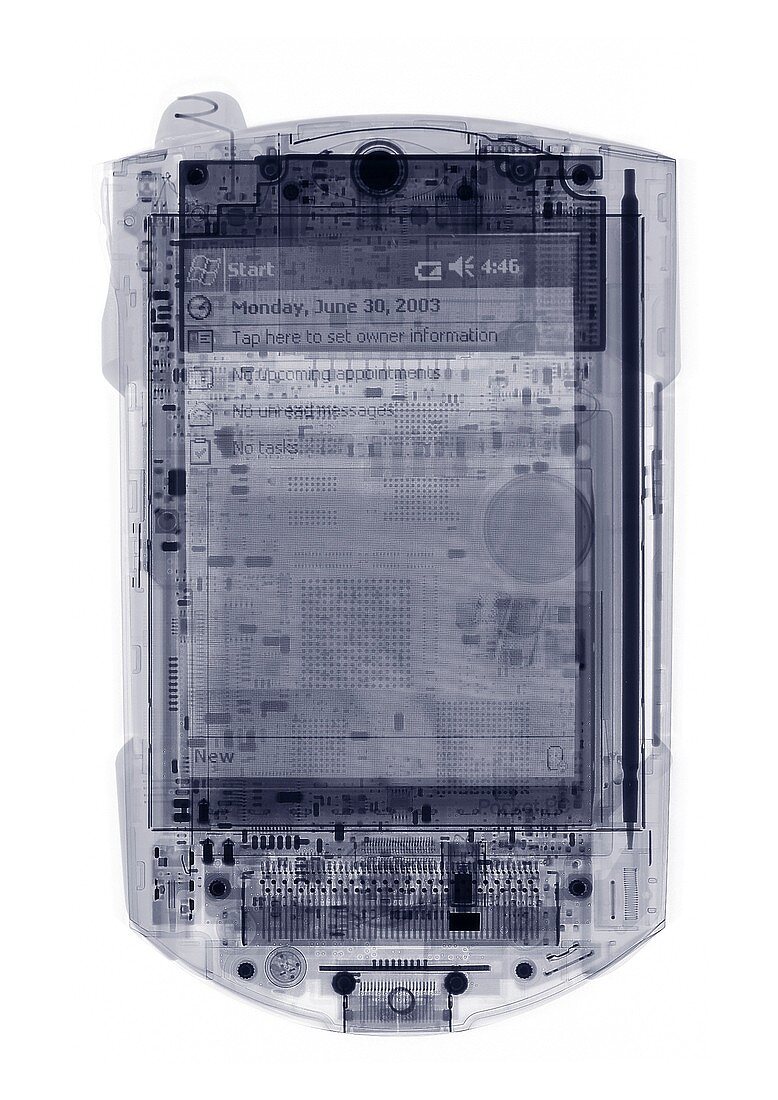 PDA, X-ray