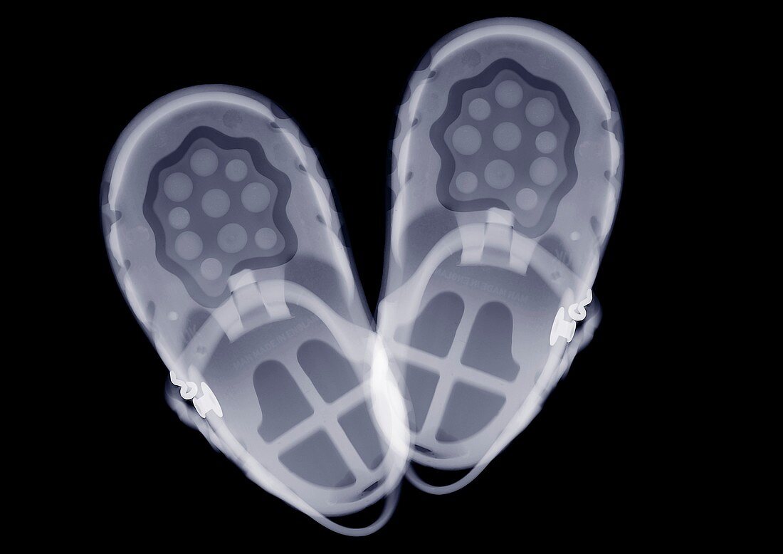 Children's jelly shoes, X-ray