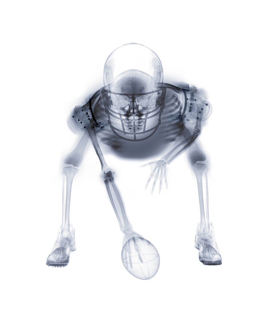 American football player skeleton, X-ray