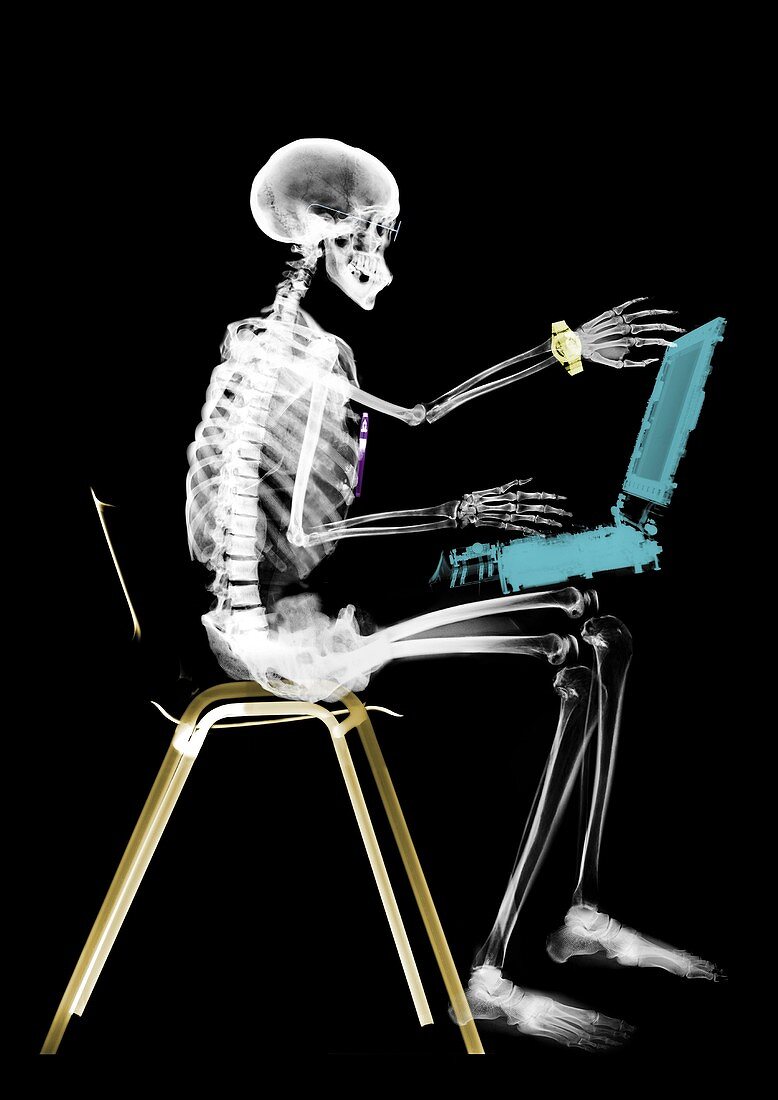 Human skeleton sitting with laptop computer, X-ray