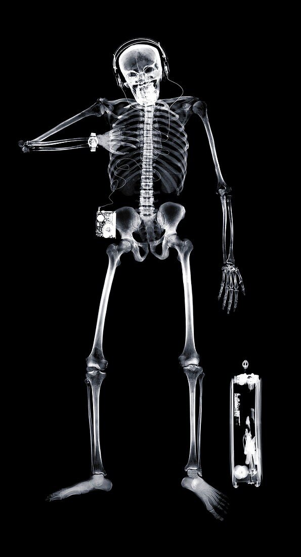 Human skeleton with briefcase and headphones, X-ray