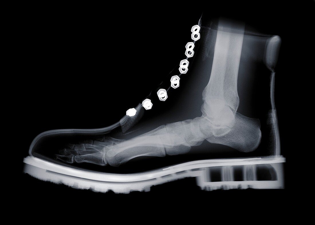 Human foot inside boot, X-ray