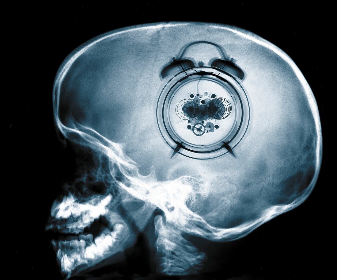 Human skull and clock, X-ray