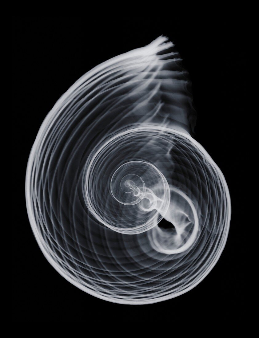 Bubble shell , X-ray