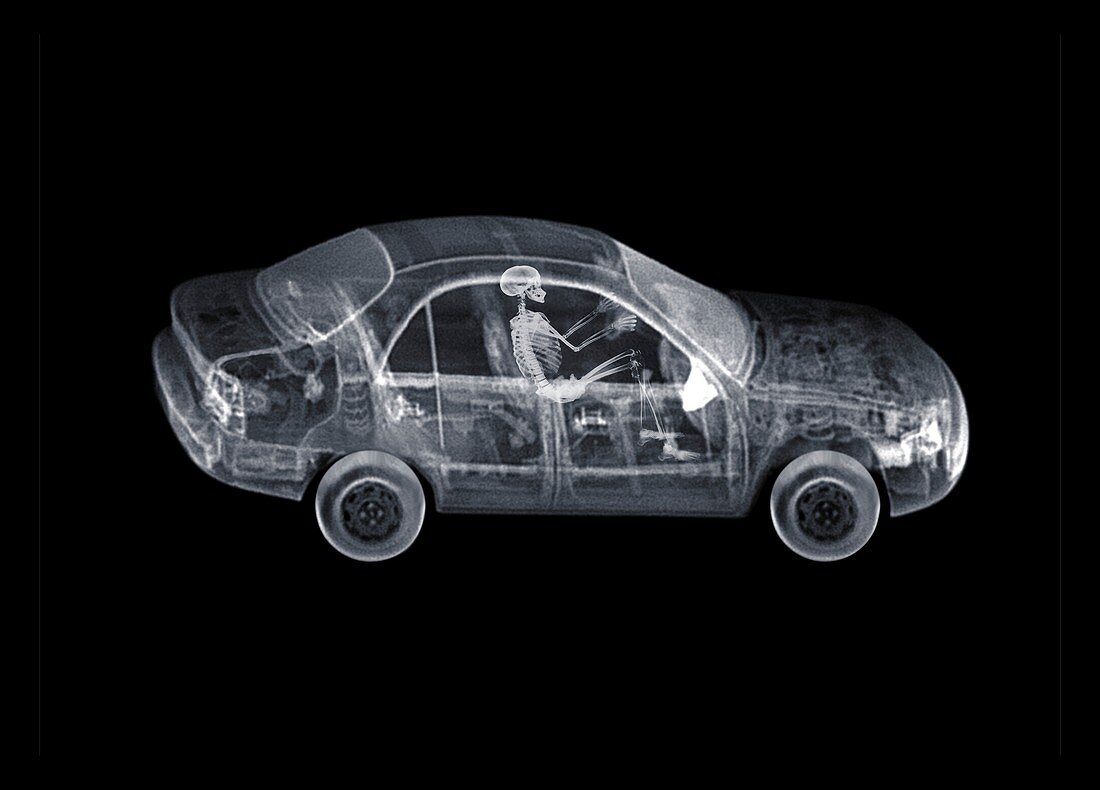 Skeleton driving car, X-ray