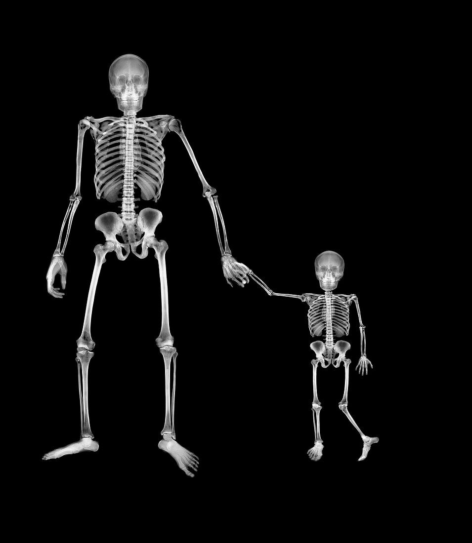 Adult and child holding hands, X-ray