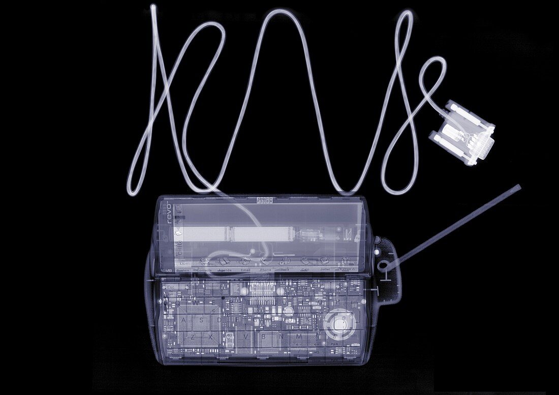 Electronic device with plug, X-ray