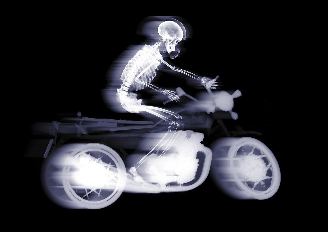 Person riding a motorcycle, X-ray