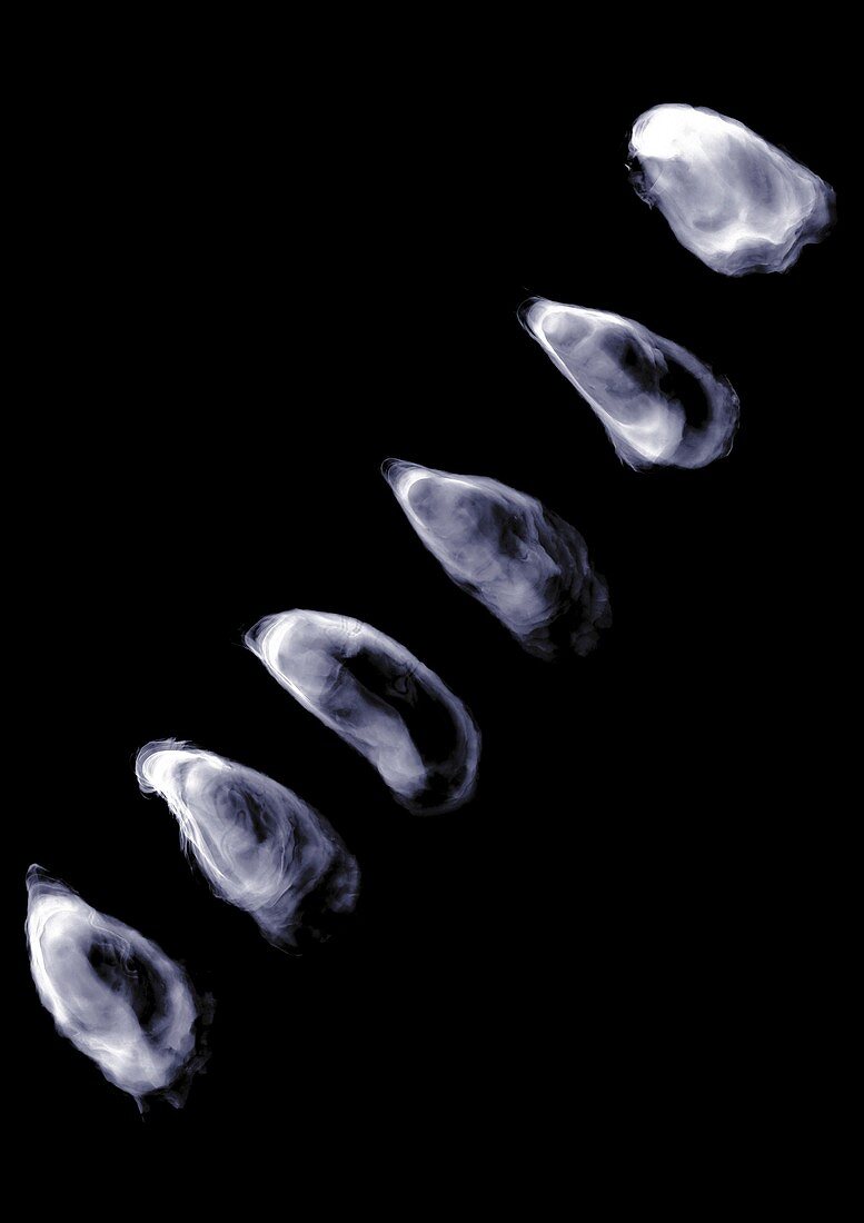 Line of oysters, X-ray