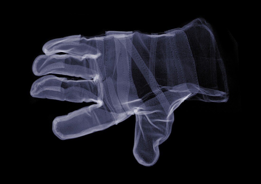 Single glove, X-ray