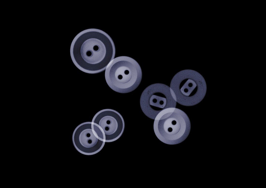 Seven buttons, X-ray