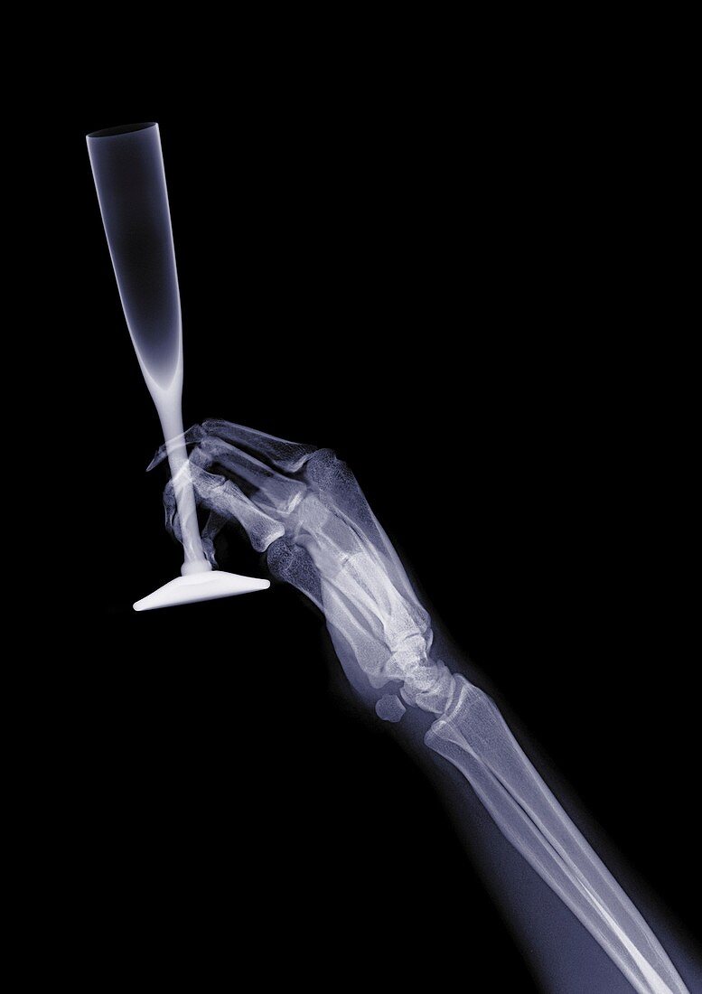 Person holding a fluted glass, X-ray