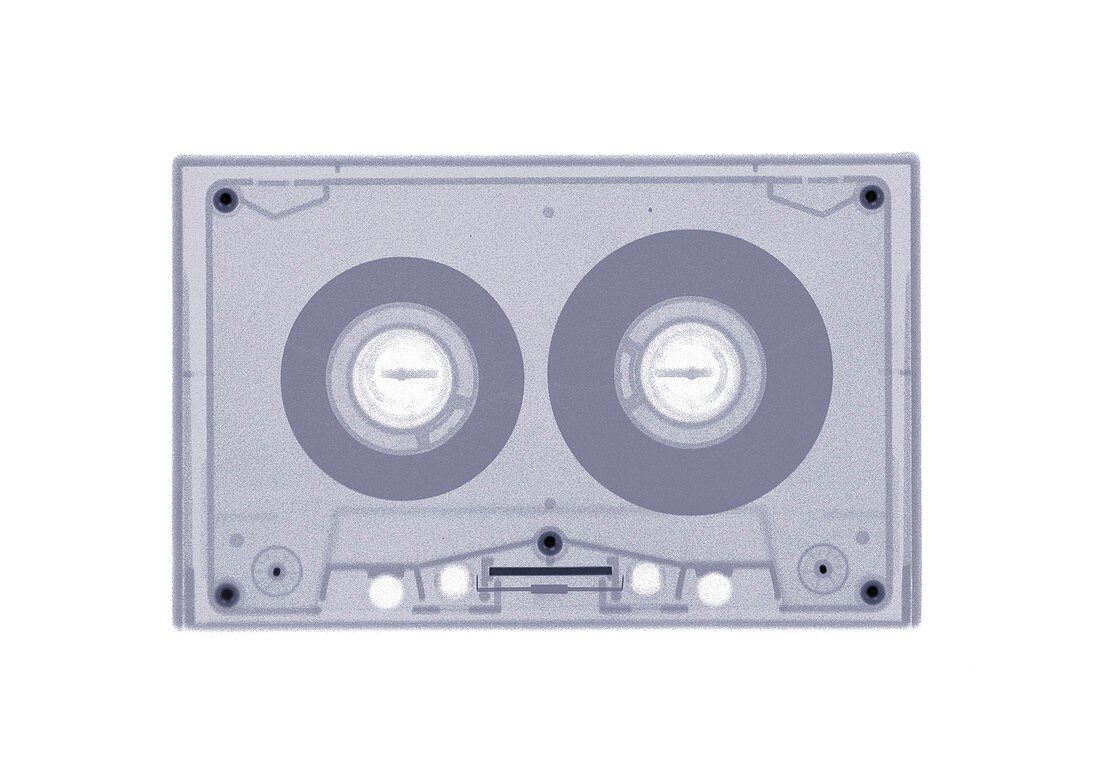 Tape cassette, X-ray