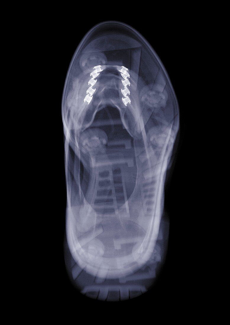 Trainer at an angle, X-ray