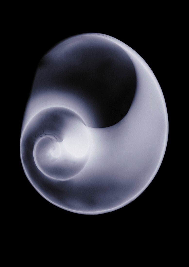 Shell, X-ray
