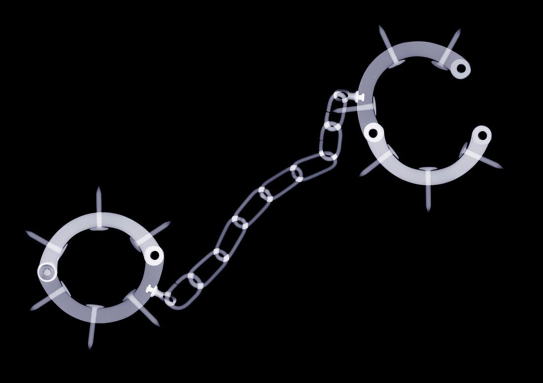 Spiked handcuffs, X-ray