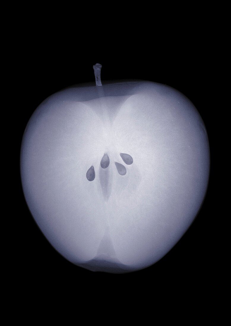 Apple, X-ray