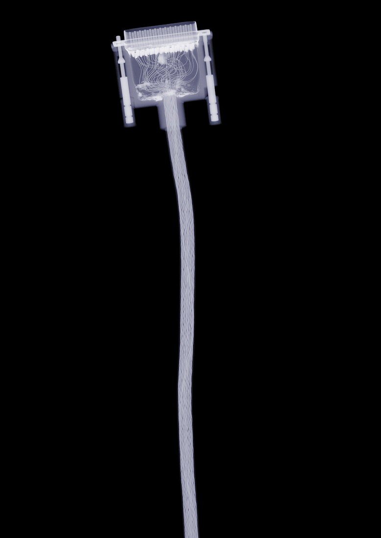Computer cable, X-ray