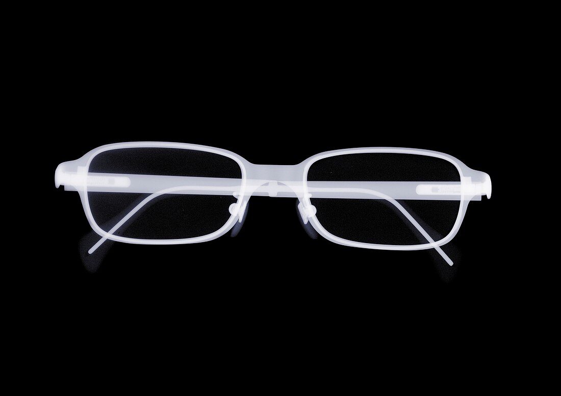Spectacles, X-ray