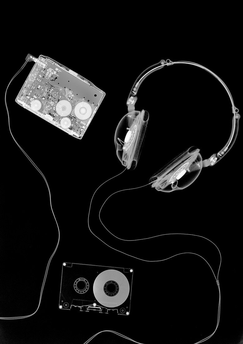 Portable tape cassette player and headphones, X-ray