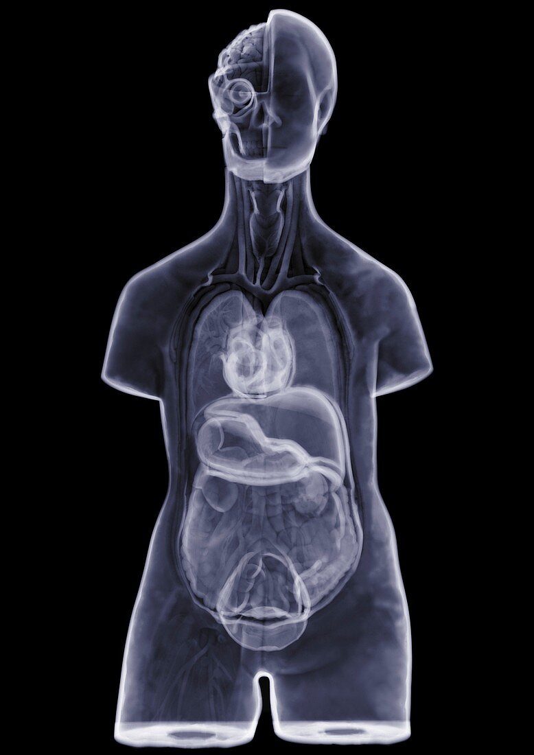 Human torso anatomical display, X-ray