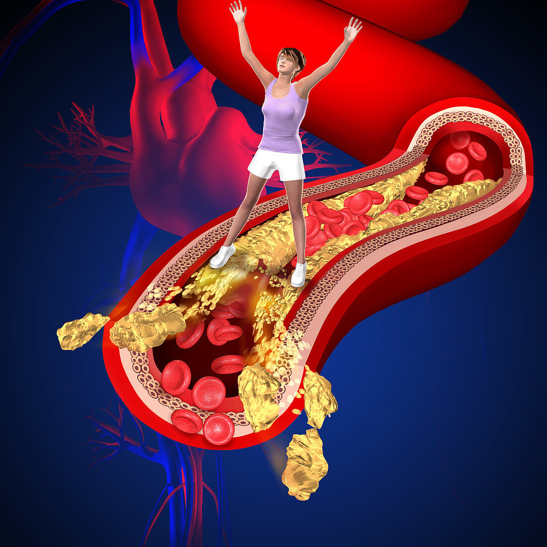 Cholesterol, illustration