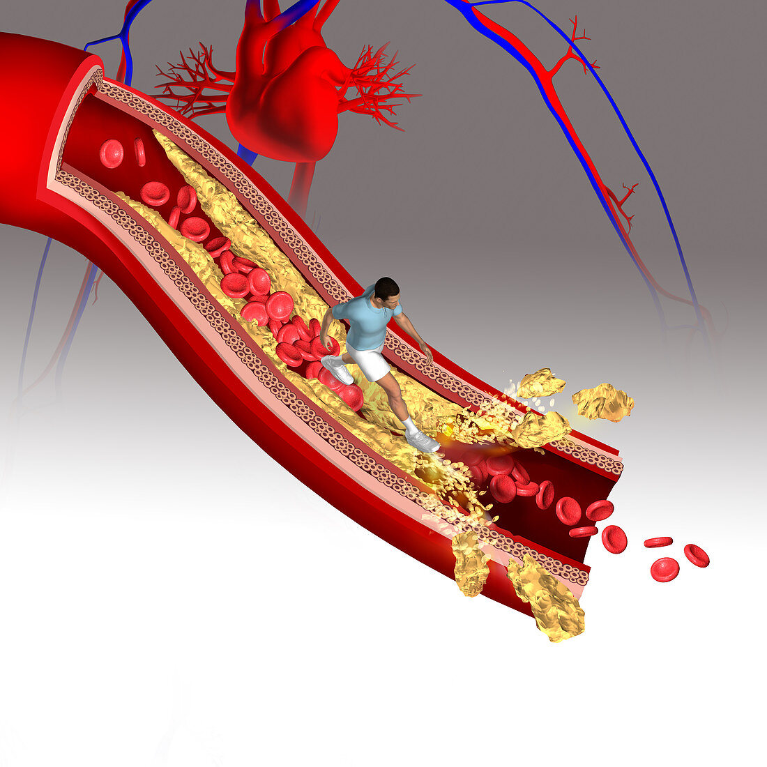 Cholesterol, illustration