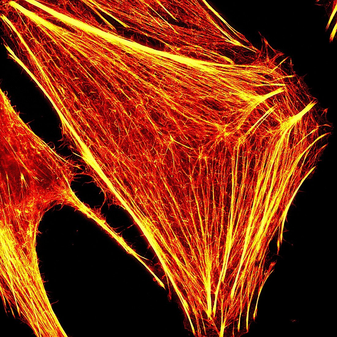 Cancer cell super resolution actin, light micrograph