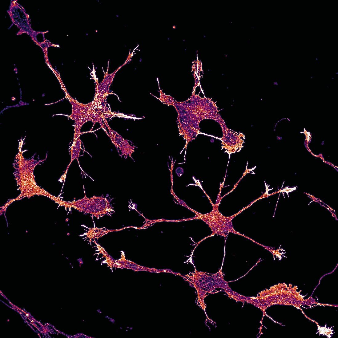 Cortical neurons showing cytoskeleton, light micrograph