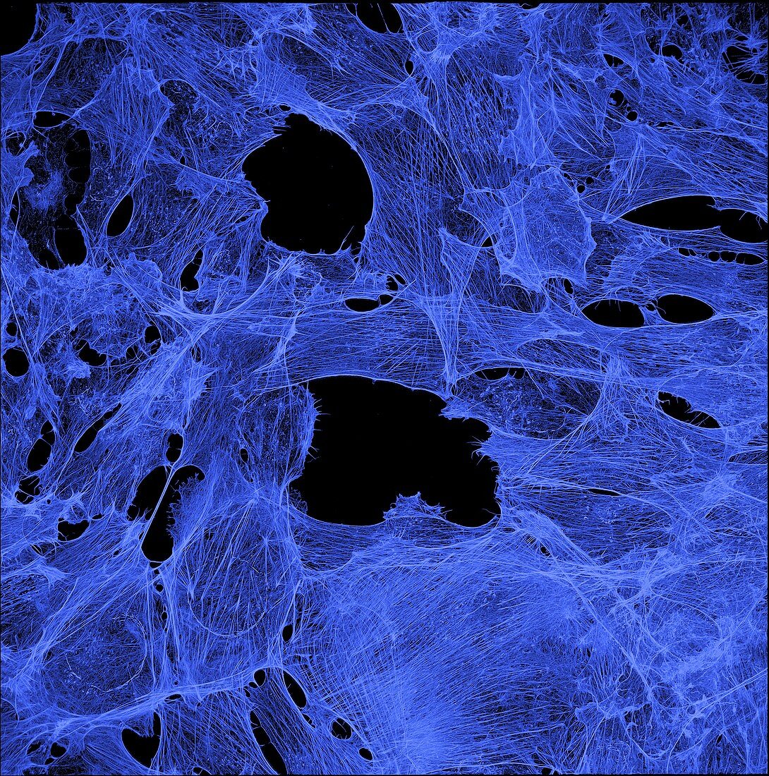 Neuroblastoma cells showing cytoskeleton, light micrograph