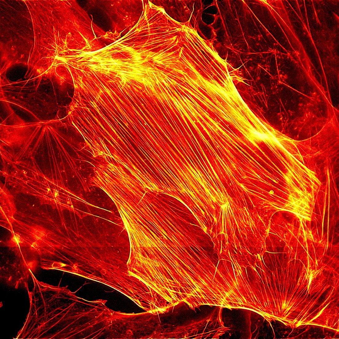 Neuroblastoma showing actin filaments, light micrograph