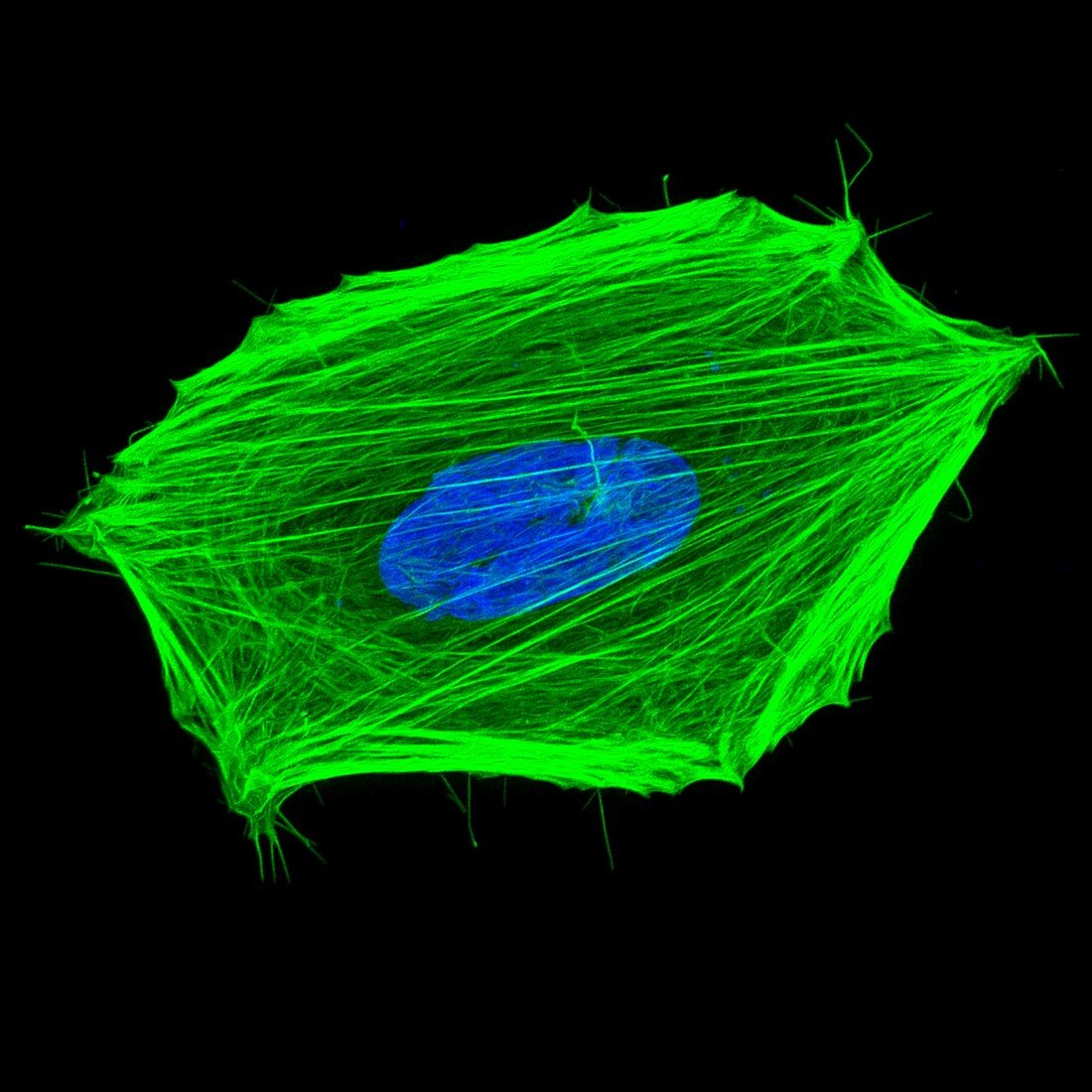 Single cancer cell, light micrograph