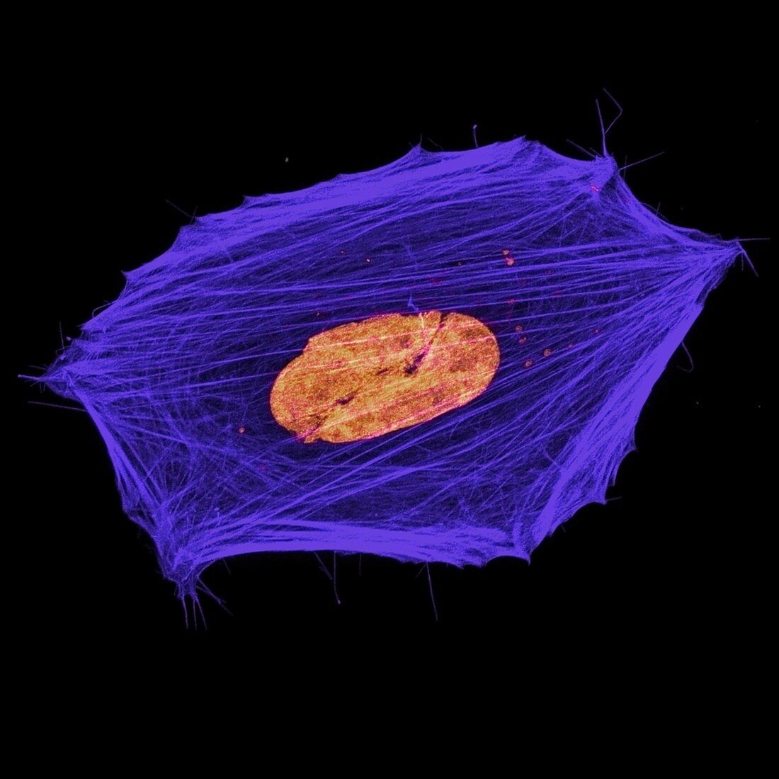 Single Neuroblastoma cell, light micrograph