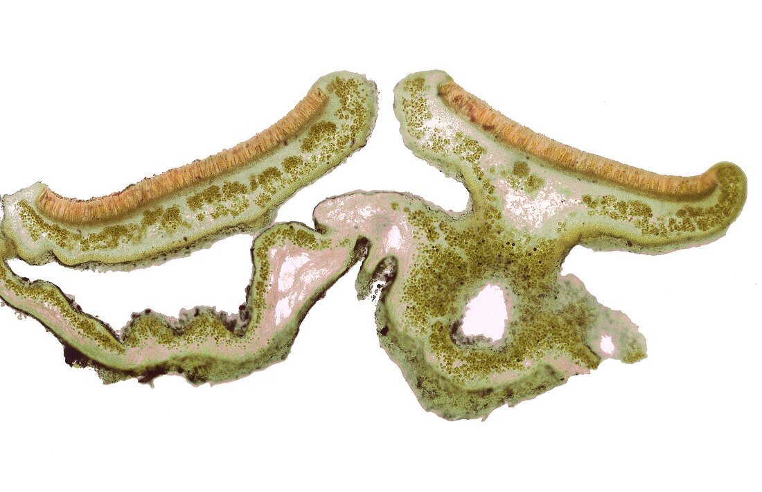 Parmelia lichen, light micrograph