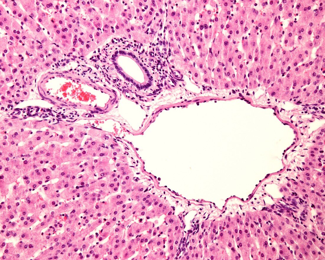 Liver portal area, light micrograph