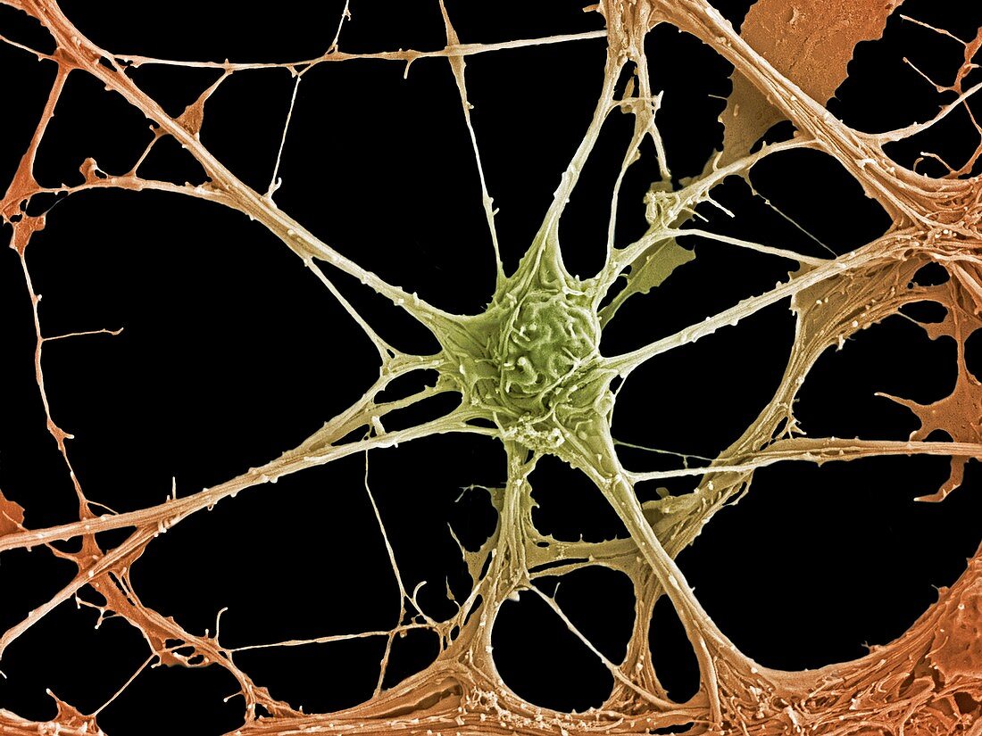 Neurone, SEM