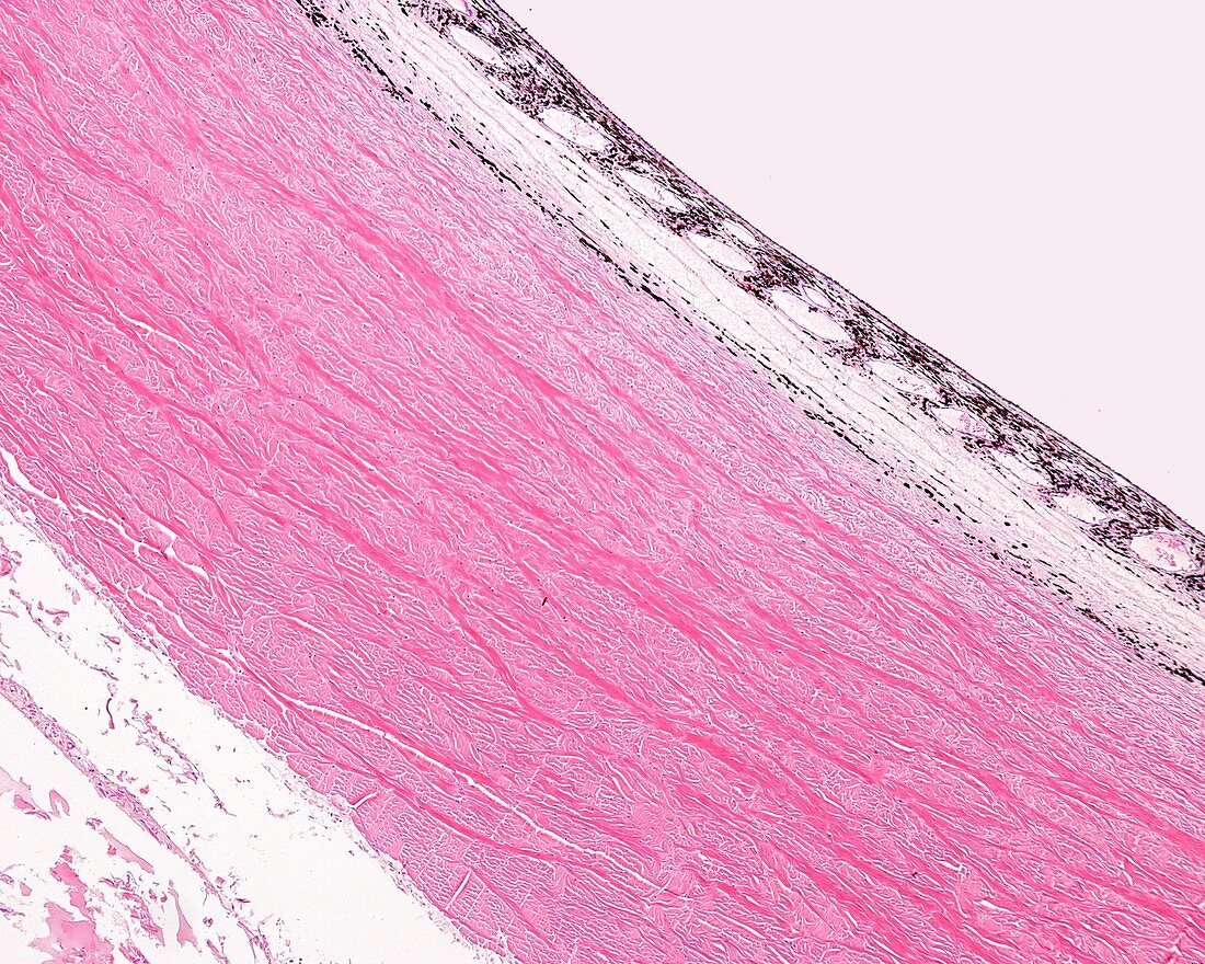 Sclera and choroid, light micrograph