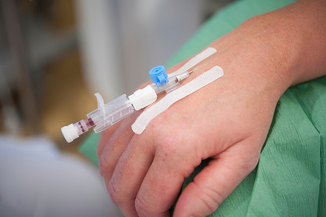 IV cannula in a patient's hand