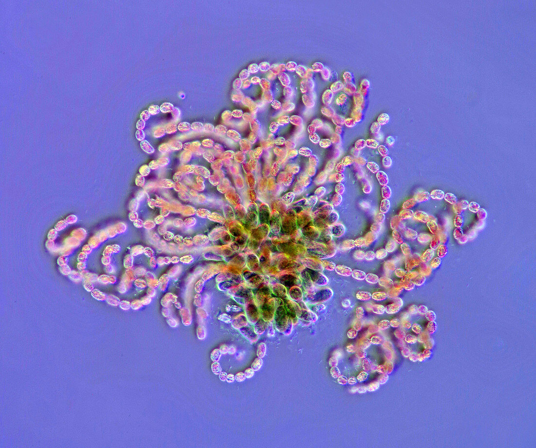 Anabaena cyanobacteria, polarised light micrograph