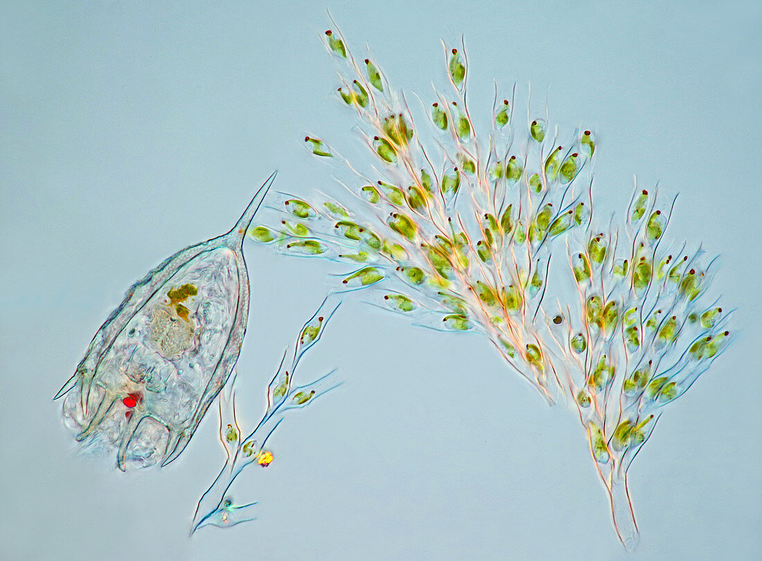 Colonial algae and rotifer, polarised light micrograph