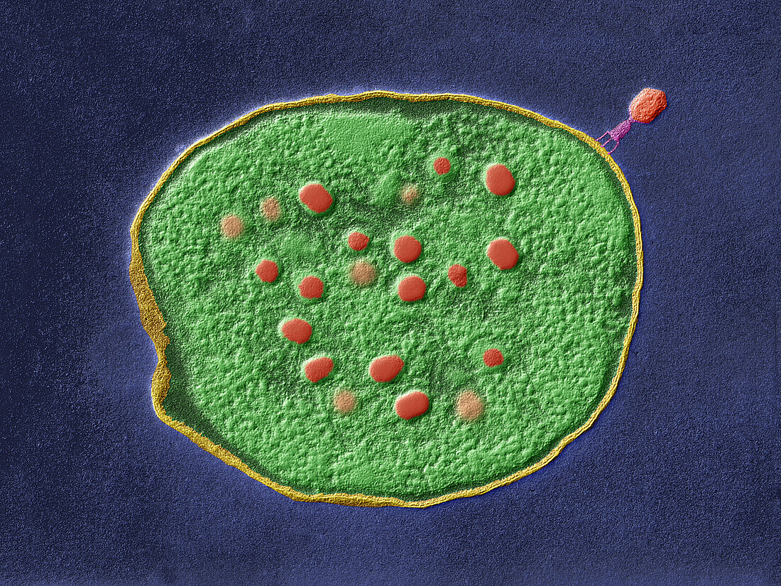 E.coli infected with T4 bacteriophages, TEM