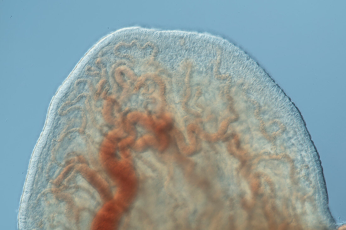 Fimbriae of a fallopian tube, light micrograph