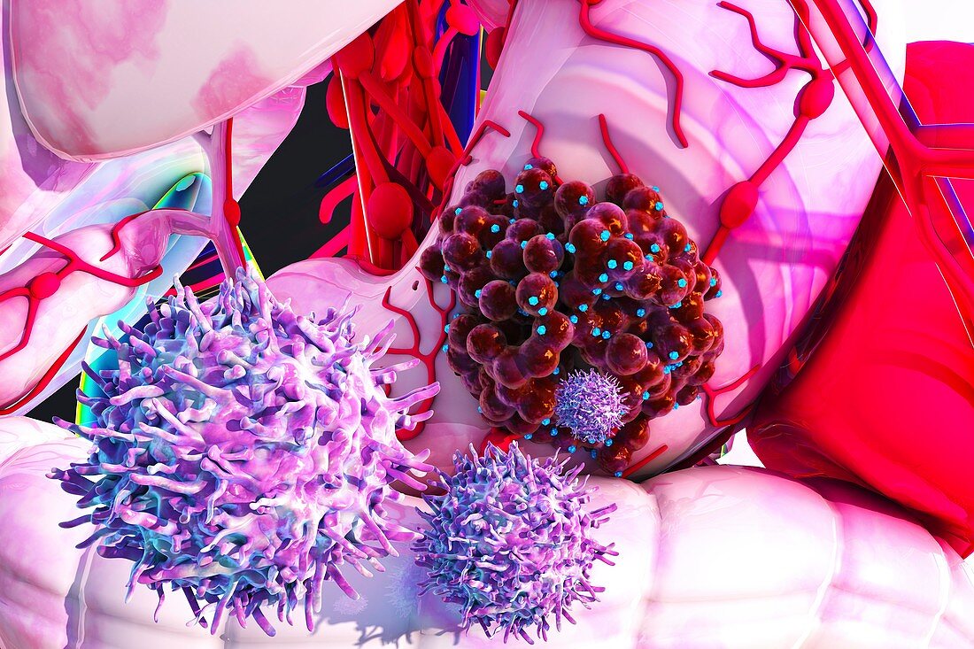 T cells attacking cancer, illustration