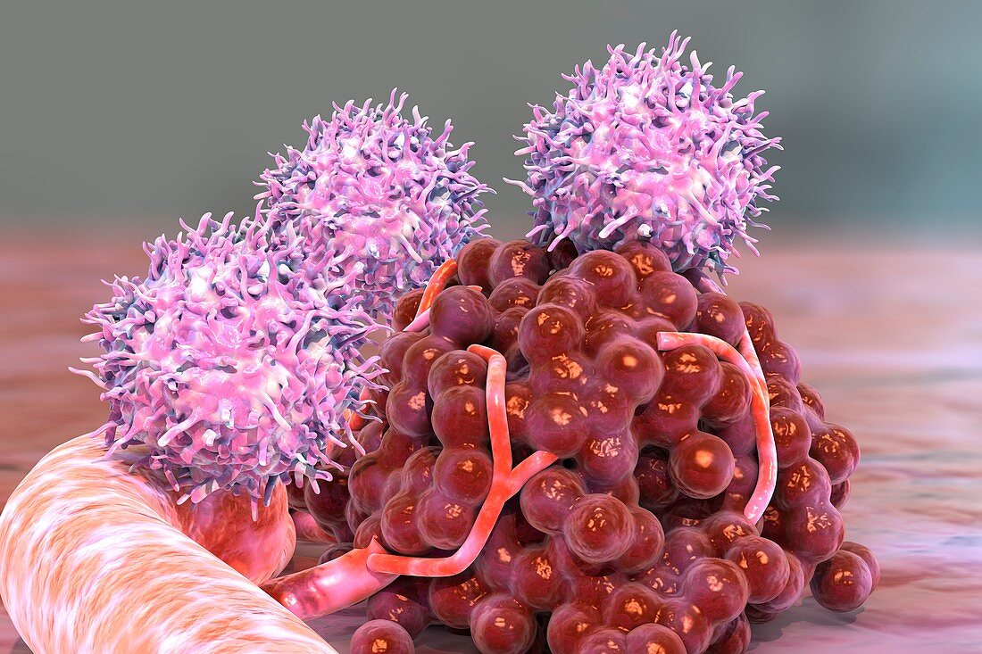 T cells attacking cancer, illustration