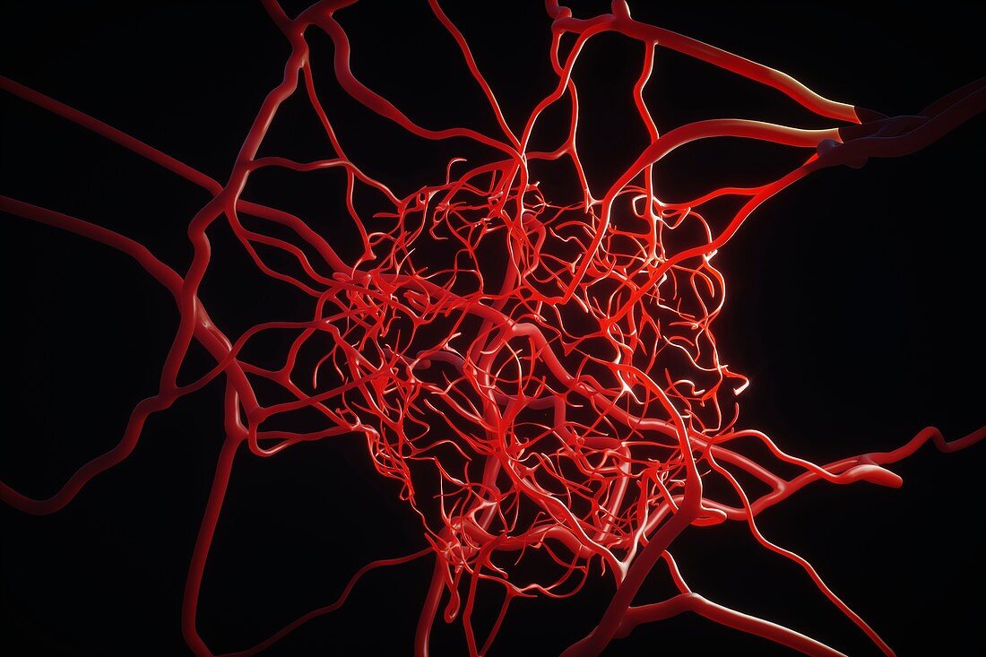 Tumour blood vessels, illustration
