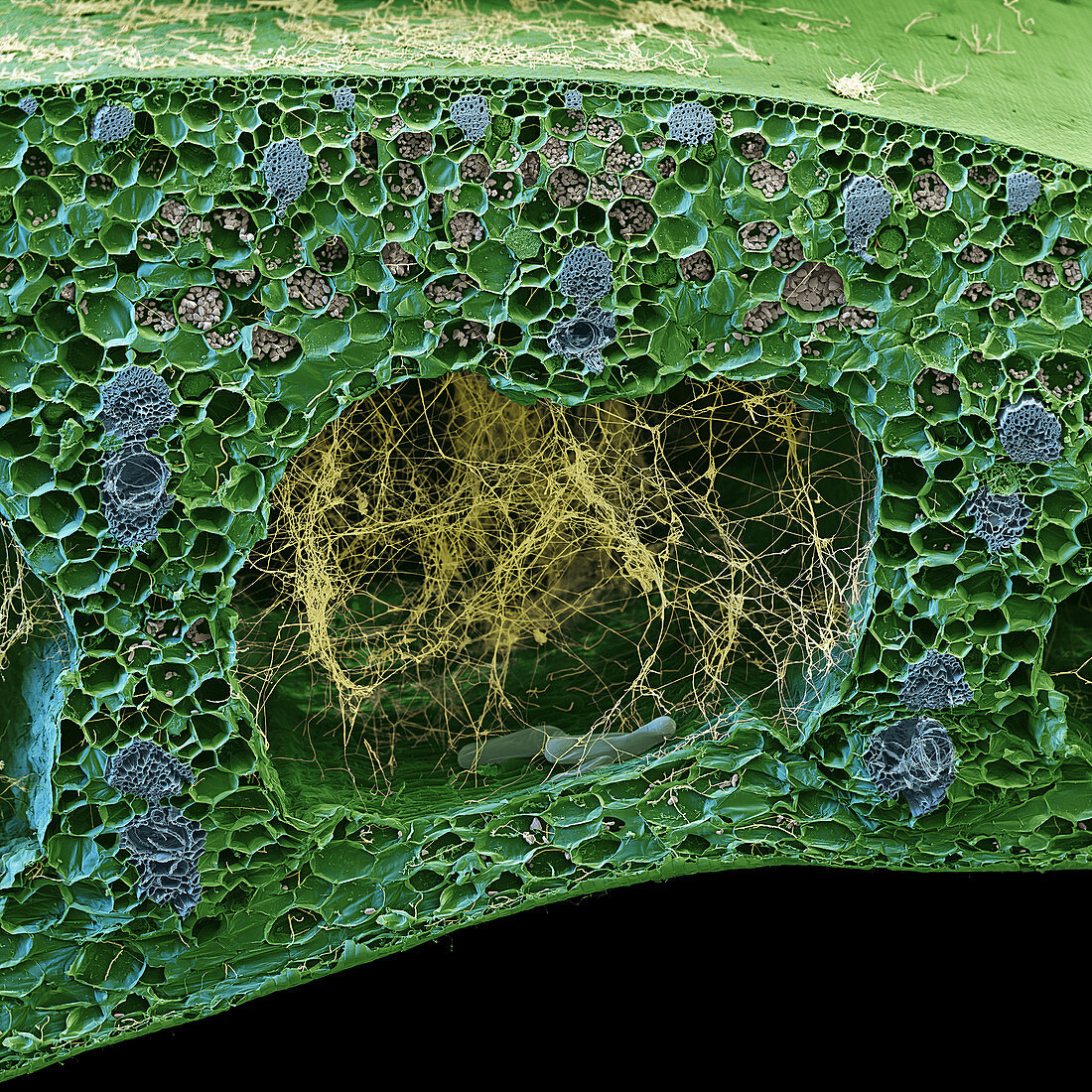 Panama disease pathogen in banana leaf, SEM