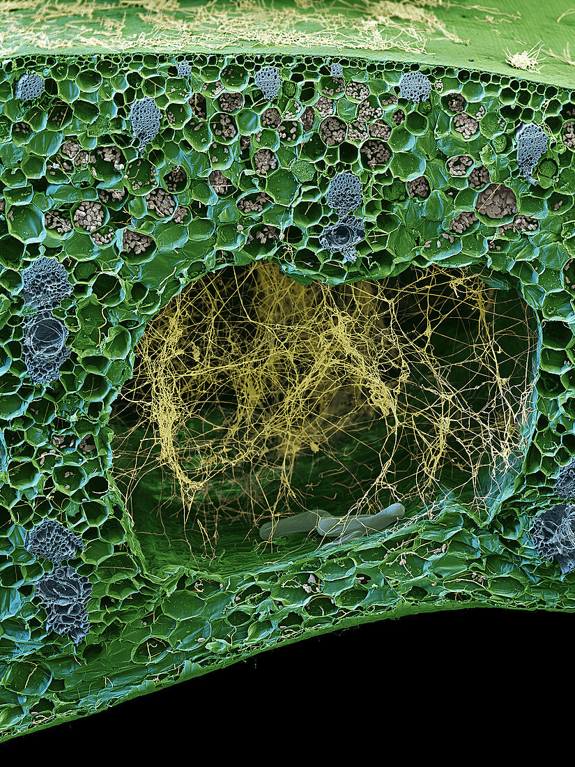 Panama disease pathogen in banana leaf, SEM